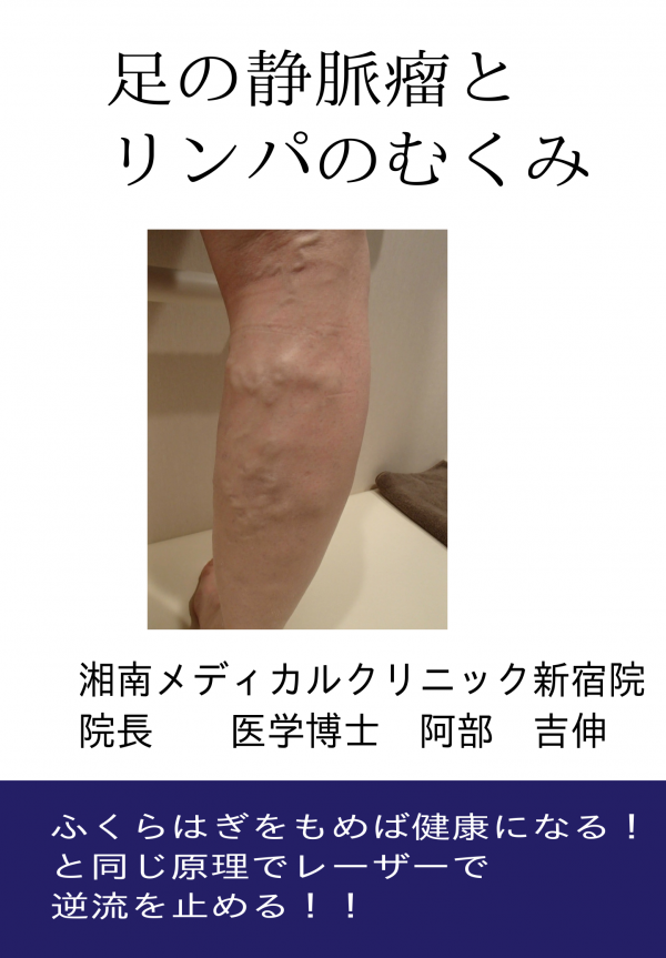 足の静脈瘤とリンパのむくみ の表紙